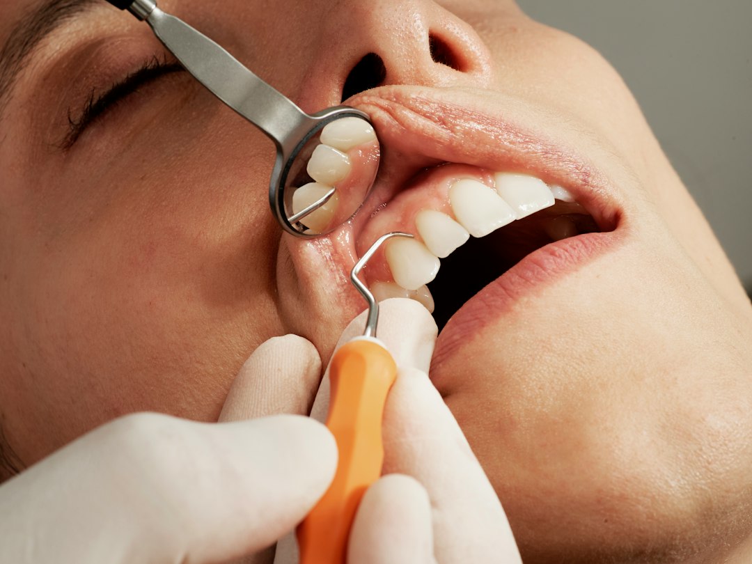 Dental exam representing gum and teeth health