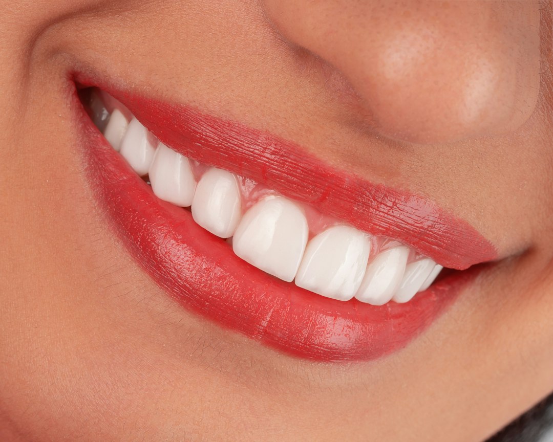 Healthy smile representing dental probiotic support